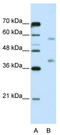Heterogeneous nuclear ribonucleoprotein A3 antibody, TA344035, Origene, Western Blot image 