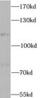 Chloride Voltage-Gated Channel 1 antibody, FNab01743, FineTest, Western Blot image 