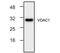 Voltage Dependent Anion Channel 1 antibody, NBP1-45921, Novus Biologicals, Western Blot image 