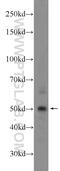 CWC25 Spliceosome Associated Protein Homolog antibody, 24416-1-AP, Proteintech Group, Western Blot image 