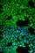 Solute Carrier Family 3 Member 1 antibody, A5500, ABclonal Technology, Immunofluorescence image 
