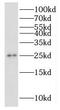 Ribonuclease P And MRP Subunit P25 antibody, FNab07453, FineTest, Western Blot image 