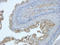 Epithelial Cell Adhesion Molecule antibody, orb10618, Biorbyt, Immunohistochemistry paraffin image 