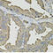 Survival Of Motor Neuron 2, Centromeric antibody, 14-470, ProSci, Immunohistochemistry paraffin image 