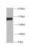 CAP-Gly domain-containing linker protein 1 antibody, FNab01763, FineTest, Western Blot image 