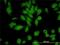 GPN-Loop GTPase 1 antibody, H00011321-M01, Novus Biologicals, Immunocytochemistry image 
