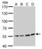 ATPase H+ Transporting V1 Subunit B2 antibody, GTX110783, GeneTex, Western Blot image 