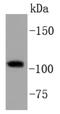 PI3 Kinase p110 beta antibody, NBP2-67579, Novus Biologicals, Western Blot image 