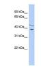 Harbinger Transposase Derived 1 antibody, NBP1-56801, Novus Biologicals, Western Blot image 