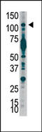 Phosphatidylinositol-4,5-Bisphosphate 3-Kinase Catalytic Subunit Beta antibody, AP14931PU-N, Origene, Western Blot image 