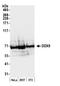 DEAD-Box Helicase 5 antibody, NB200-351, Novus Biologicals, Western Blot image 