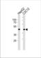 SMAD Family Member 3 antibody, TA325124, Origene, Western Blot image 