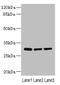 Bisphosphoglycerate Mutase antibody, LS-C675427, Lifespan Biosciences, Western Blot image 