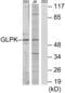 Glycerol Kinase antibody, abx013464, Abbexa, Western Blot image 
