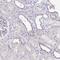 Leukocyte Receptor Cluster Member 9 antibody, NBP2-30893, Novus Biologicals, Immunohistochemistry paraffin image 