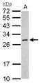 Proteasome Subunit Alpha 6 antibody, GTX113530, GeneTex, Western Blot image 