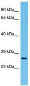 ETS Proto-Oncogene 1, Transcription Factor antibody, TA329150, Origene, Western Blot image 