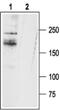Sodium Voltage-Gated Channel Alpha Subunit 11 antibody, PA5-77733, Invitrogen Antibodies, Western Blot image 