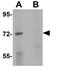 Transcription Factor 3 antibody, GTX31402, GeneTex, Western Blot image 