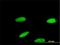 Zinc Finger Protein 587 antibody, H00084914-M01, Novus Biologicals, Immunocytochemistry image 