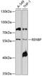 Renin Binding Protein antibody, 13-373, ProSci, Western Blot image 