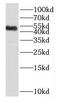 Dual specificity protein phosphatase 10 antibody, FNab02562, FineTest, Western Blot image 