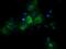 Retinoic Acid Receptor Responder 1 antibody, MA5-26246, Invitrogen Antibodies, Immunocytochemistry image 