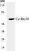 Cyclin B1 antibody, EKC1152, Boster Biological Technology, Western Blot image 