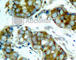 Cell Division Cycle 25A antibody, AP0321, ABclonal Technology, Immunohistochemistry paraffin image 