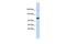 U2 SnRNP Associated SURP Domain Containing antibody, GTX47177, GeneTex, Western Blot image 