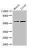Potassium Voltage-Gated Channel Subfamily A Member 1 antibody, orb48541, Biorbyt, Western Blot image 