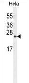 TIMP Metallopeptidase Inhibitor 4 antibody, LS-C161893, Lifespan Biosciences, Western Blot image 