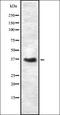 Carcinoembryonic Antigen Related Cell Adhesion Molecule 6 antibody, orb336988, Biorbyt, Western Blot image 