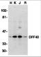 DNA Fragmentation Factor Subunit Beta antibody, 2107, ProSci, Western Blot image 