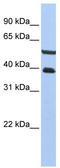 Phosphatase And Actin Regulator 3 antibody, TA337603, Origene, Western Blot image 
