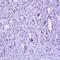 Zinc Finger CCCH-Type Containing 8 antibody, orb74280, Biorbyt, Immunohistochemistry paraffin image 