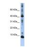 LSM6 Homolog, U6 Small Nuclear RNA And MRNA Degradation Associated antibody, NBP1-57318, Novus Biologicals, Western Blot image 