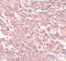 Breast Carcinoma Amplified Sequence 4 antibody, A13963-1, Boster Biological Technology, Immunohistochemistry paraffin image 