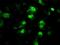 Protein Phosphatase Methylesterase 1 antibody, NBP2-02240, Novus Biologicals, Immunocytochemistry image 