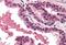 DNA Fragmentation Factor Subunit Alpha antibody, MBS240364, MyBioSource, Immunohistochemistry paraffin image 