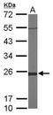 Glyoxalase I antibody, TA308044, Origene, Western Blot image 
