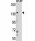 Lysine Demethylase 6B antibody, F40552-0.4ML, NSJ Bioreagents, Western Blot image 