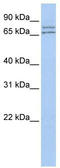 DEAD-Box Helicase 27 antibody, TA341603, Origene, Western Blot image 