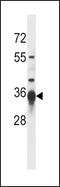 Sirtuin 3 antibody, PA5-13222, Invitrogen Antibodies, Western Blot image 