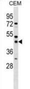 Single-stranded DNA-binding protein 3 antibody, abx029262, Abbexa, Western Blot image 