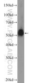 Estrogen Receptor 2 antibody, 14007-1-AP, Proteintech Group, Western Blot image 