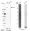 Ring Finger Protein 213 antibody, PA5-51902, Invitrogen Antibodies, Western Blot image 