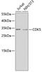 Cyclin Dependent Kinase 5 antibody, 18-767, ProSci, Western Blot image 