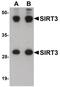 Sirtuin 3 antibody, PA5-20971, Invitrogen Antibodies, Western Blot image 