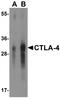 Cytotoxic T-Lymphocyte Associated Protein 4 antibody, TA355059, Origene, Western Blot image 